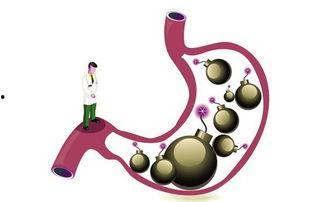 胃病热门话题,胃病困扰？揭秘热门话题中的胃病防治之道