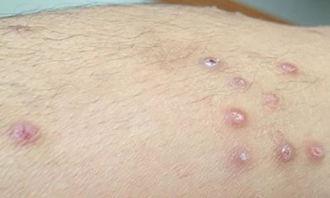 湿气热门话题,揭秘中医视角下的湿气问题与应对策略